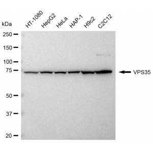 KD-Validated VPS35 Rabbit mAb (20 μl)
