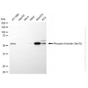 KD-Validated Phospho-VIM (Ser72) Rabbit mAb (20 μl)