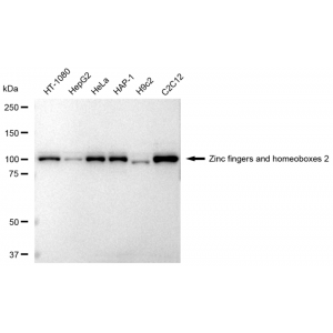 KD-Validated ZHX2 Rabbit mAb (20 μl)
