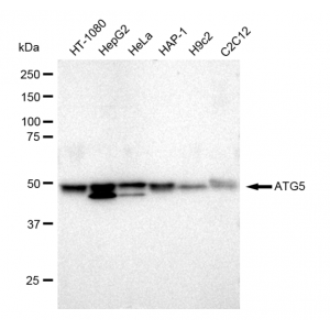 KD-Validated ATG5 Rabbit mAb (20 μl)