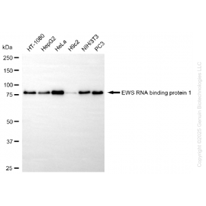 KD-Validated EWSR1 Rabbit mAb (20 μl)