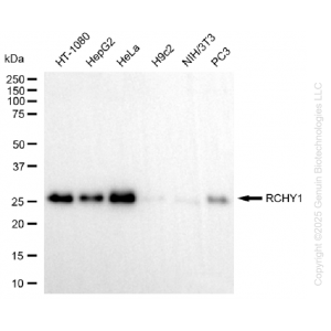 KD-Validated RCHY1 Rabbit mAb (20 μl)