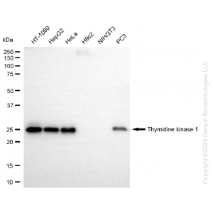 KD-Validated TK1 Rabbit mAb (20 μl)
