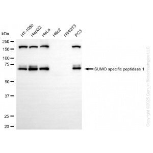 KD-Validated SENP1 Rabbit mAb (20 μl)