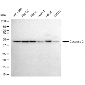 KD-Validated CASP2 Rabbit mAb (20 μl)