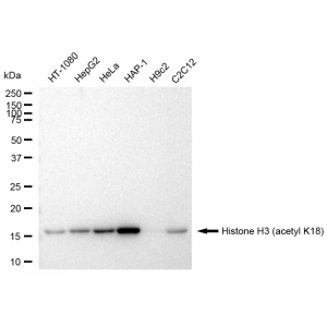 KD-Validated Histone H3 (acetyl K18) Rabbit mAb (20 μl)