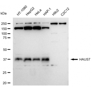 KD-Validated HAUS7 Rabbit mAb (20 μl)