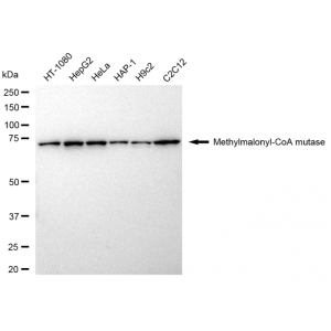KD-Validated MMUT Rabbit mAb (20 μl)