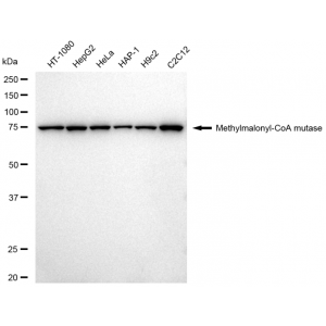 KD-Validated MMUT Rabbit mAb (20 μl)
