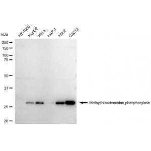 KD-Validated MTAP Rabbit mAb (20 μl)