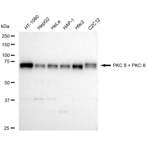 KD-Validated PRKCD Rabbit mAb (20 μl)