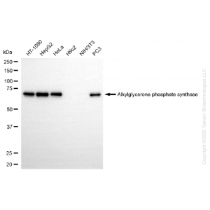 KD-Validated AGPS Rabbit mAb (20 μl)