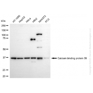 KD-Validated CAB39 Rabbit mAb (20 μl)
