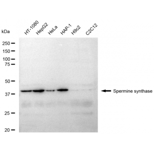 KD-Validated SMS Rabbit mAb (20 μl)