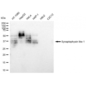 KD-Validated SYPL1 Rabbit mAb (20 μl)