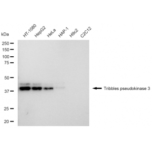 KD-Validated TRIB3 Rabbit mAb (20 μl)