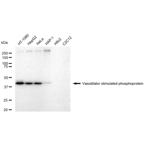 KD-Validated VASP Rabbit mAb (20 μl)
