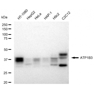 KD-Validated ATP1B3 Rabbit mAb (20 μl)