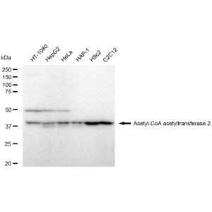 KD-Validated ACAT2 Rabbit mAb (20 μl)