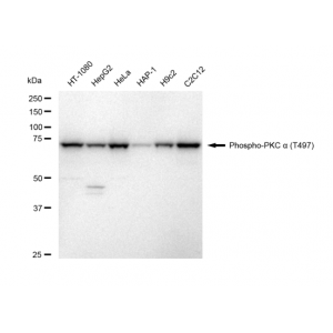 KD-Validated Phospho-PKCA (T497) Rabbit mAb (20 μl)