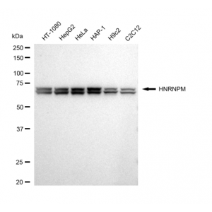 KD-Validated HNRNPM Rabbit mAb (20 μl)