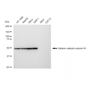 KD-Validated KATNA1 Rabbit mAb (20 μl)