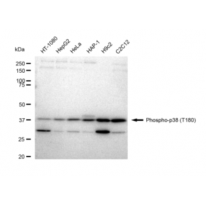 KD-Validated Phospho-p38 (T180) Rabbit mAb (20 μl)