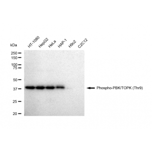 KD-Validated Phospho-PBK (Thr9) Rabbit mAb (20 μl)