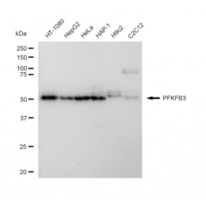 KD-Validated PFKFB3 Rabbit mAb (20 μl)