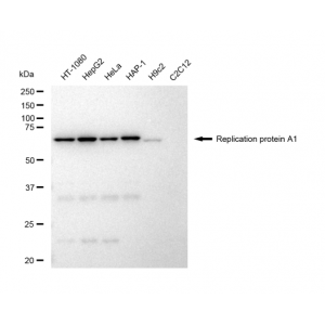 KD-Validated RPA1 Rabbit mAb (20 μl)