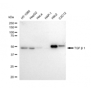 KD-Validated TGFB1 Rabbit mAb (20 μl)
