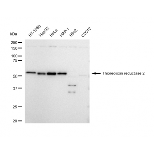 KD-Validated TXNRD2 Rabbit mAb (20 μl)