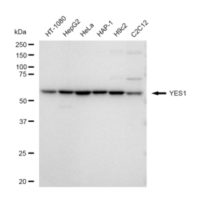 KD-Validated YES1 Rabbit mAb (20 μl)