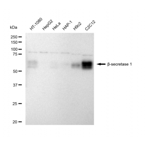 KD-Validated BACE1 Rabbit mAb (20 μl)