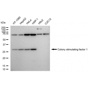KD-Validated CSF1 Rabbit mAb (20 μl)