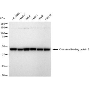 KD-Validated CTBP2 Rabbit mAb (20 μl)