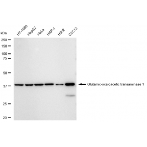KD-Validated GOT1 Rabbit mAb (20 μl)