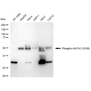 KD-Validated Phospho-GATA3 (S308) Rabbit mAb (20 μl)