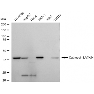 KD-Validated CTSL Rabbit mAb (20 μl)