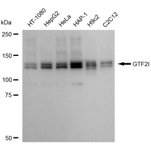 KD-Validated GTF2I Rabbit mAb (20 μl)