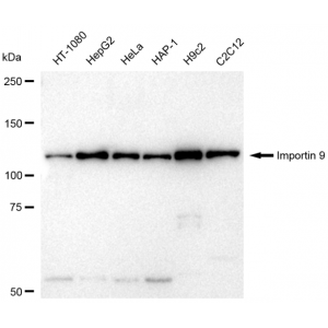 KD-Validated IPO9 Rabbit mAb (20 μl)