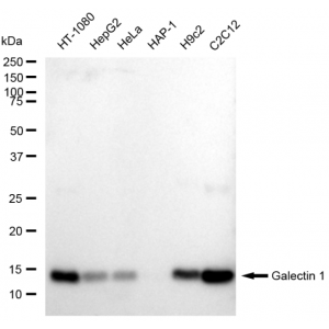 KD-Validated LGALS1 Rabbit mAb (20 μl)
