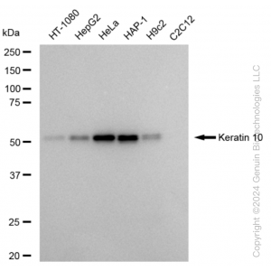KD-Validated KRT10 Rabbit mAb (20 μl)