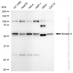 KD-Validated KRT4 Rabbit mAb (20 μl)