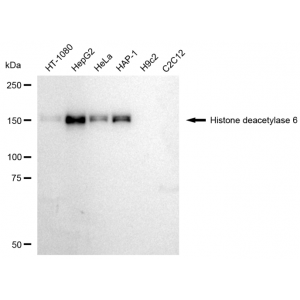 KD-Validated HDAC6 Rabbit mAb (20 μl)