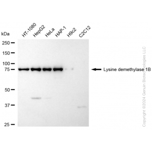 KD-Validated KDM1B Rabbit mAb (20 μl)