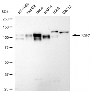 KD-Validated KSR1 Rabbit mAb (20 μl)
