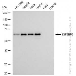 KD-Validated IGF2BP3 Rabbit mAb (20 μl)