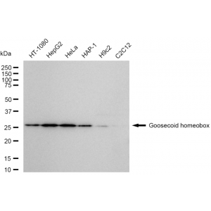 62199-WB-1-300x300-1.webp KD-Validated GSC Rabbit mAb (20 μl)