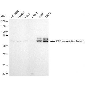 KD-Validated E2F1 Rabbit mAb (20 μl)